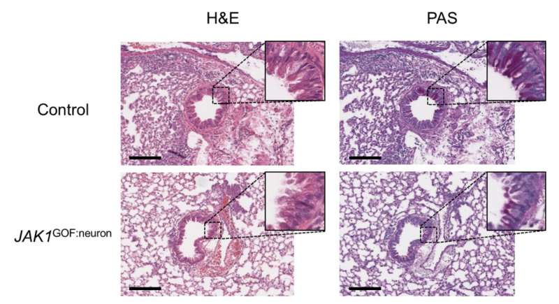 Study reveals new insights on tissue-dependent roles of JAK signaling in inflammation