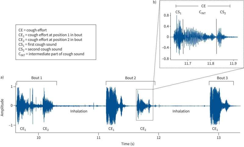 Analyzing cough sounds to identify the severity of COVID-19 patients