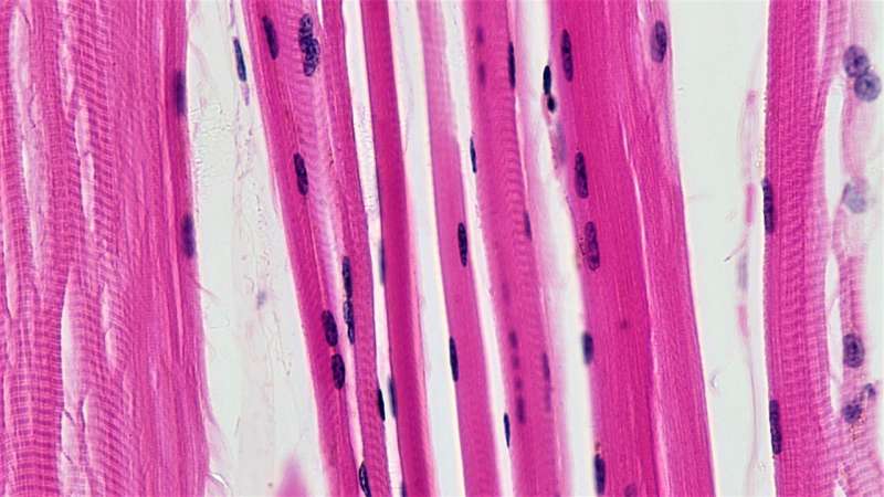 Skeletal muscle fibers. Credit: Berkshire Community College Bioscience Image Library / Public domain