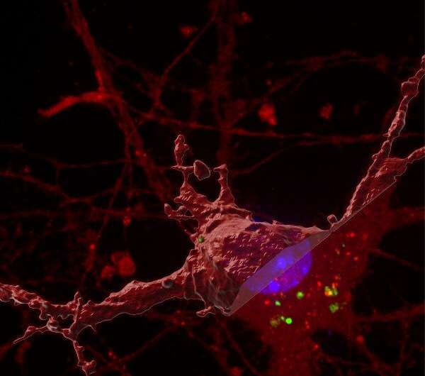 New discovery for how the brain 'tangles' in Alzheimer's disease 