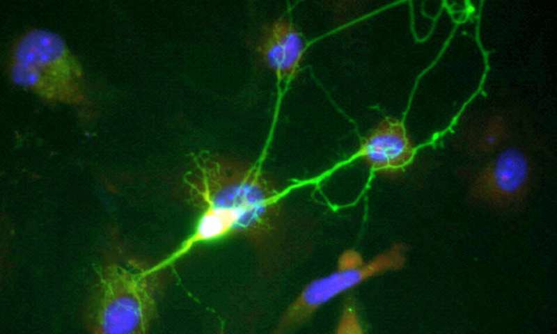 Alzheimer research: Noise-inducing neurons shut down memories 