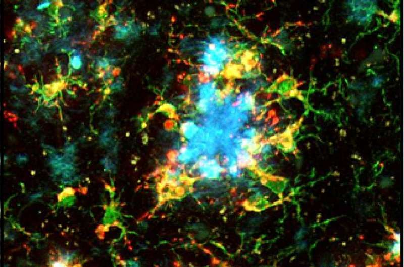 Alzheimer's research—intracellular calcium store malfunction leads to brain hyperactivity 