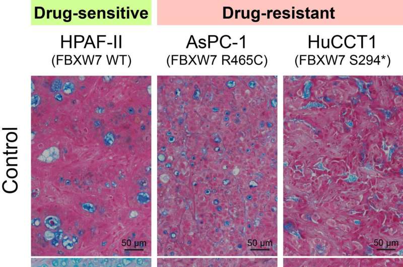 Scientists uncover key resistance mechanism to Wnt inhibitors in pancreatic and colorectal cancers