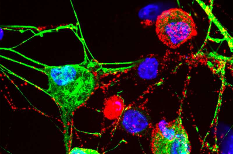 Cell's 'garbage disposal' may have another role: Helping neurons near skin sense the environment