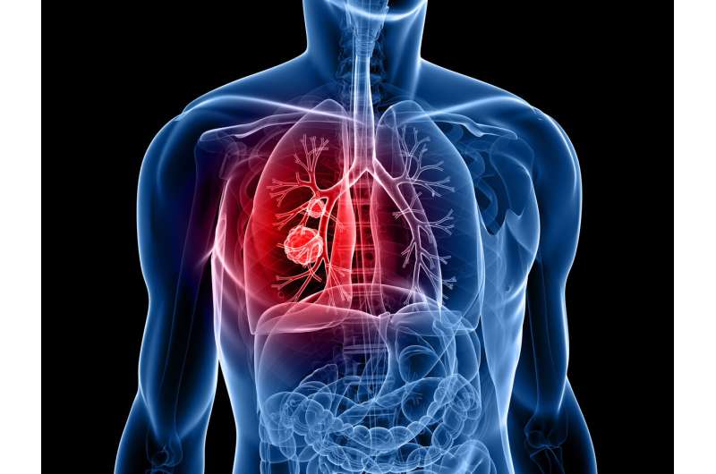 Adding immunotherapy after initial treatment can benefit metastatic lung cancer patients 