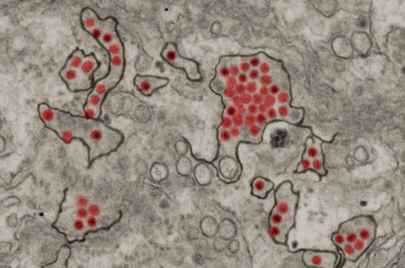 Unusual type of antibody shows ultrapotent activity against Zika 
