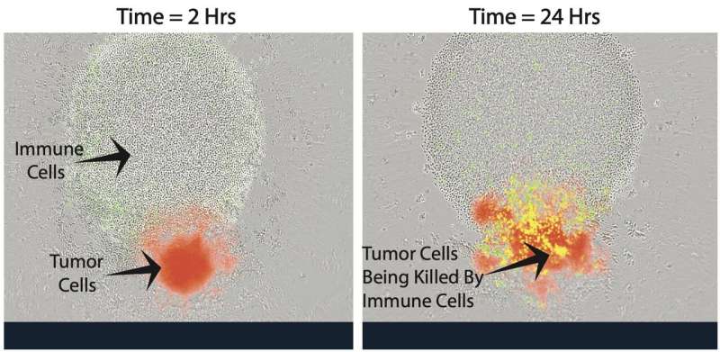 A new way to help the immune system fight back against cancer 
