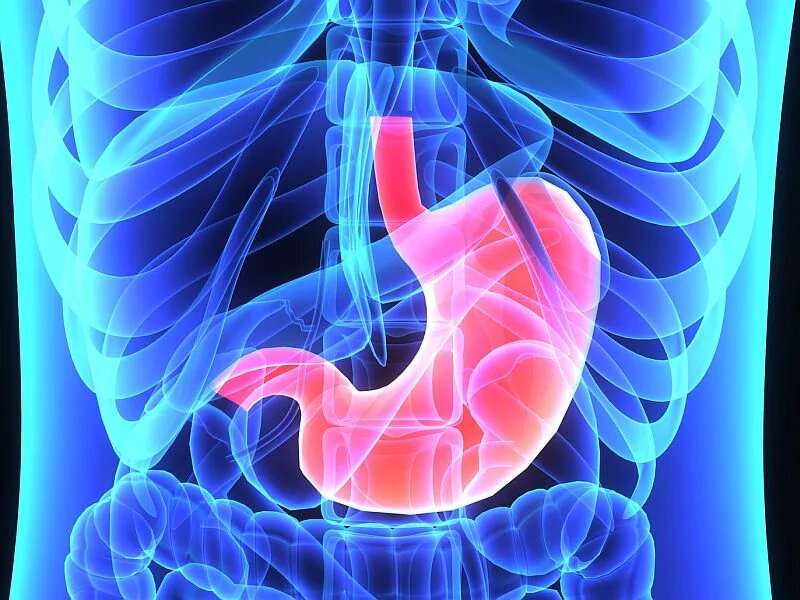 H. pylori treatment may reduce gastric cancer incidence, death 