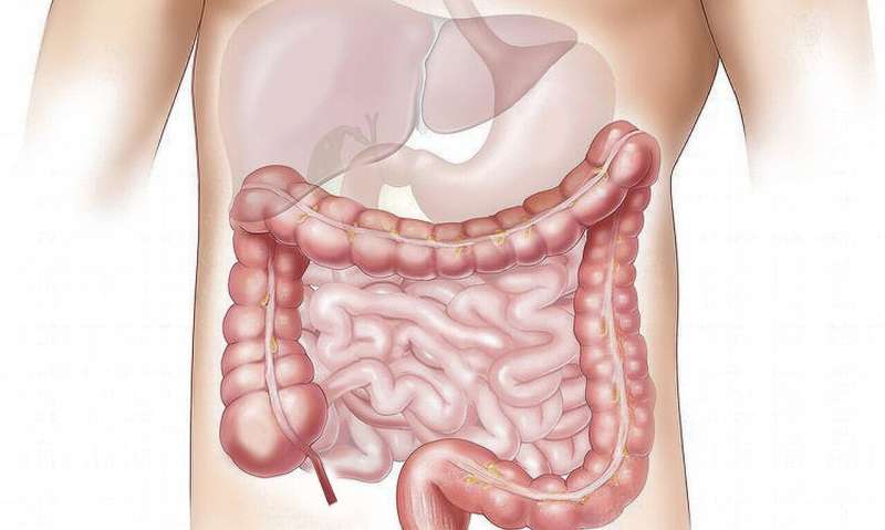 Q and A: Polyps are possible culprits in colon cancer 