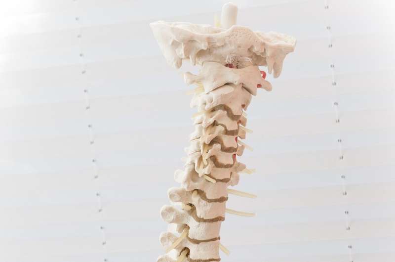 Q and A: Spinal arthritis 