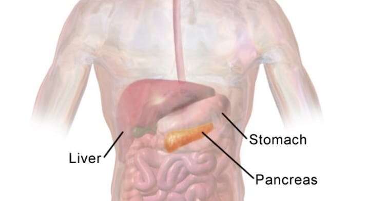 Pancreatic cancer specialist explains treatment advances and challenges 