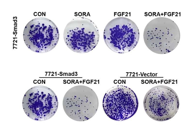 Study suggests the possibility of combination therapy of SORA and FGF21 in hepatocellular carcinoma 