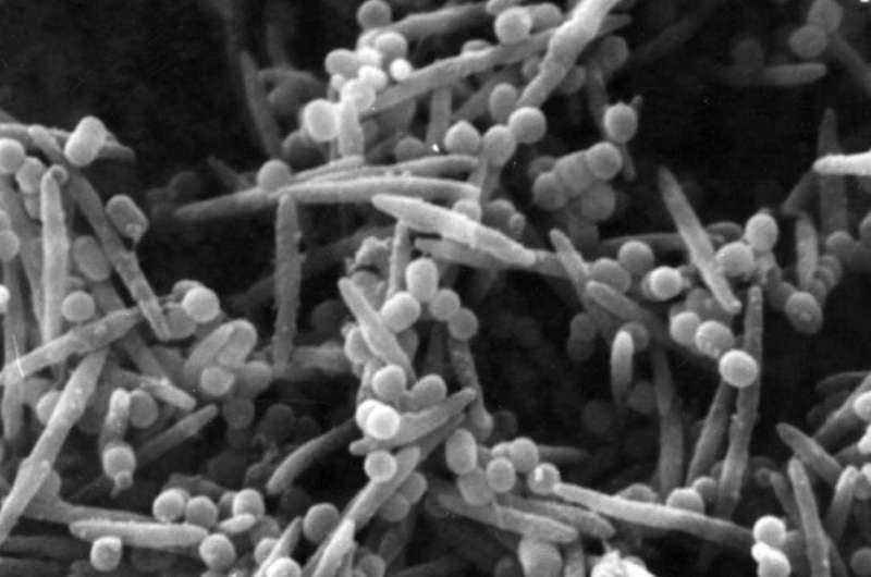 How a common oral bacteria makes colon cancer more deadly 
