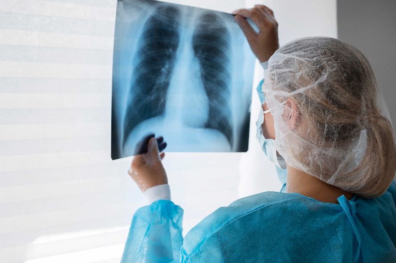  AI Model for Estimating Pulmonary Function from Chest X-rays