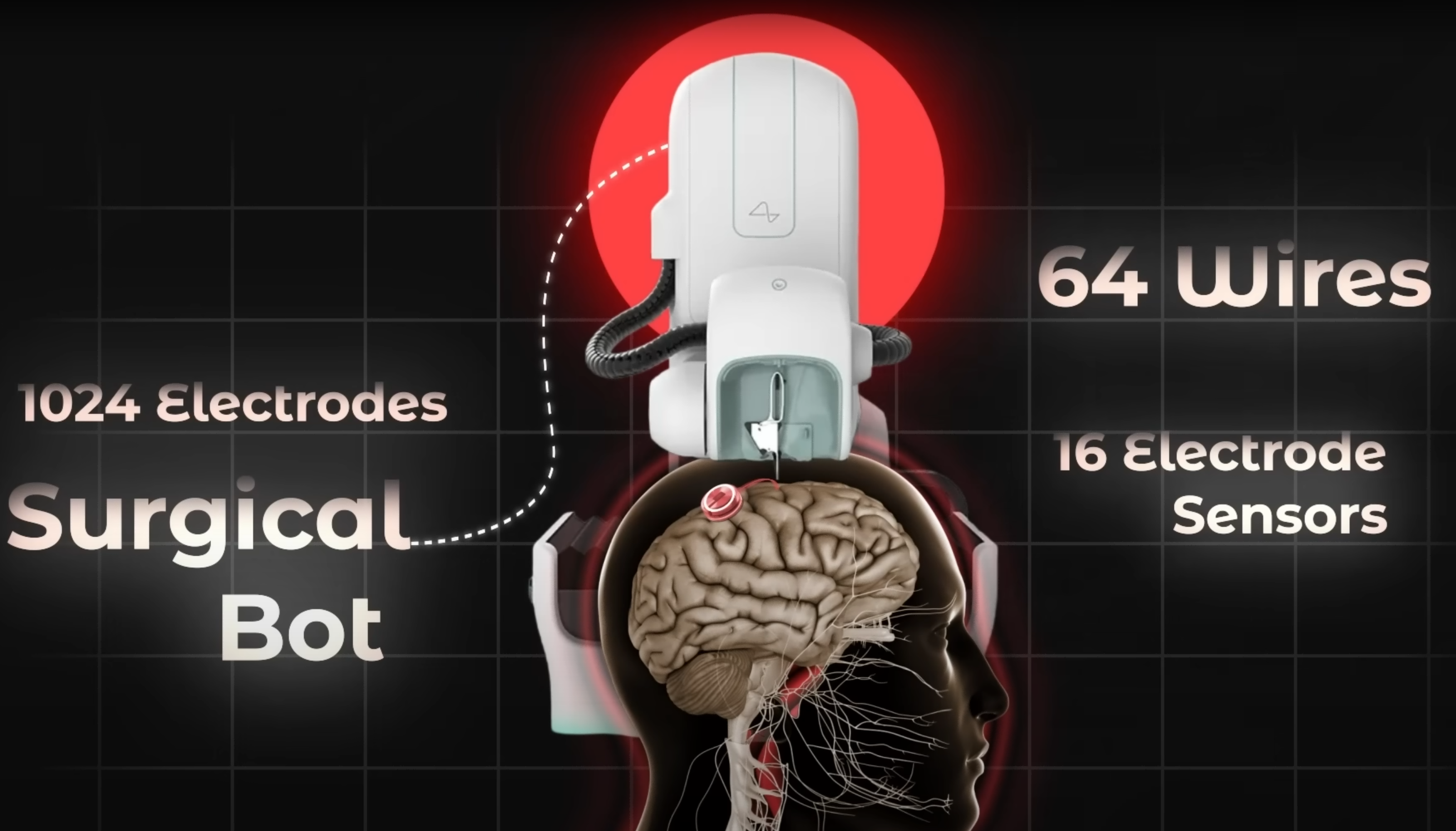 Neuralink Begins First Human Experiments!