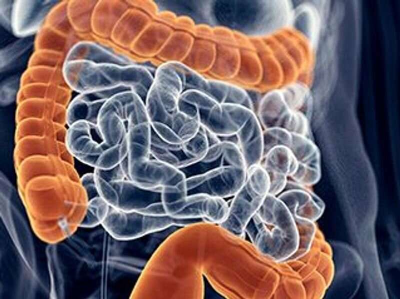 CRP can help assess severity of acute ulcerative colitis