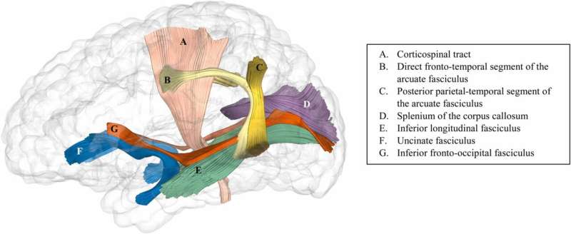 Researchers illustrate how caregiver speech shapes infant brain