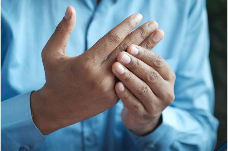 Clinical trial shows rheumatoid arthritis drug could prevent disease 
