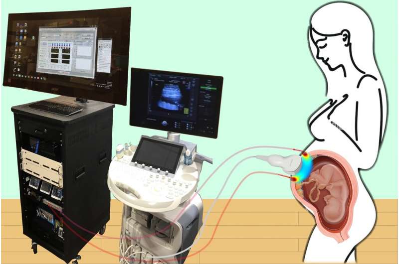 A novel method for monitoring the 'engine' of pregnancy 