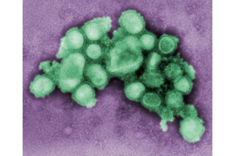 UK confirms first human case of swine flu strain H1N2 